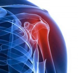 боль в левом плече может быть симптомом артрита