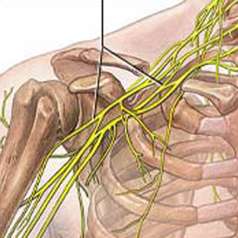 болезни плеча могут вызываться заболеваниями нервной системы